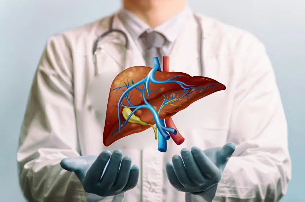 Fatty Liver Treatment